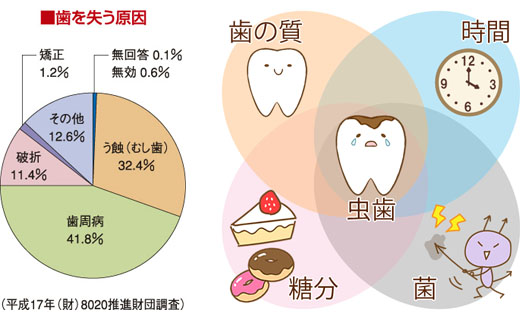 歯を失う原因