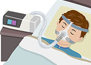 CPAP